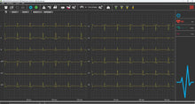 Lade das Bild in den Galerie-Viewer, PC-EKG SmartScript